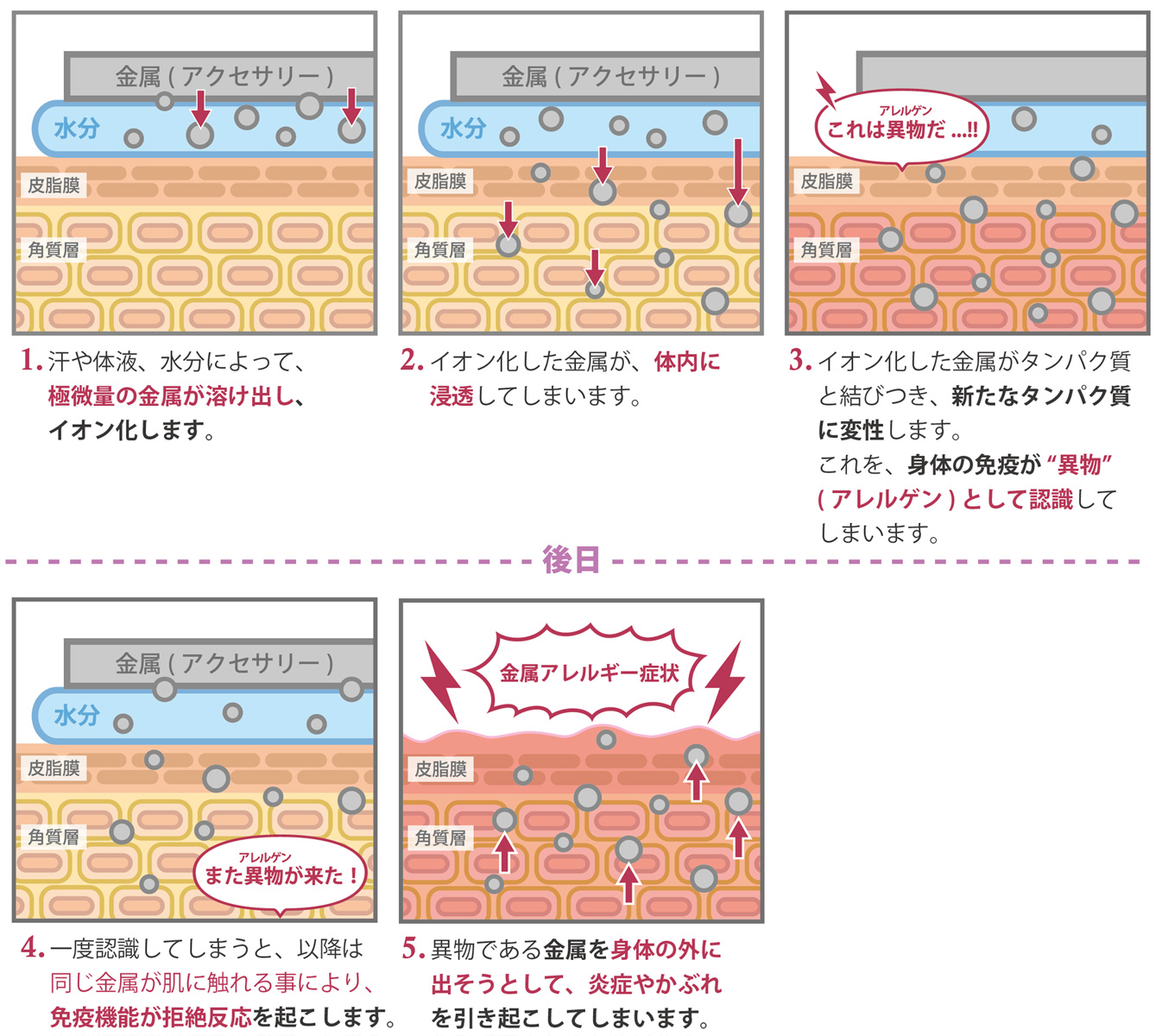 人気 金属食器 口当たりが悪い アレルギー